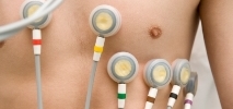 procedimiento-electrocardiograma